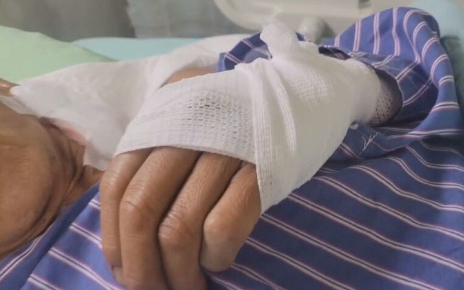 61歲男晨跑遭3狗攻擊生殖器也受傷　警找到飼主將釐清責任