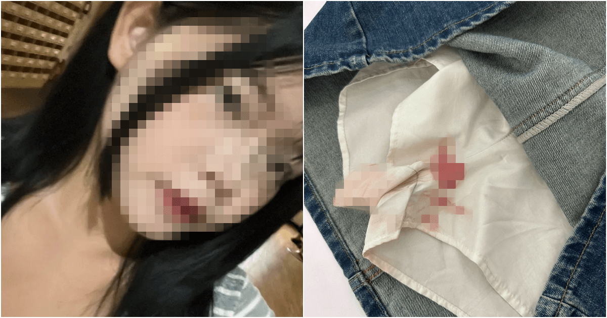 網紅試穿「經血沾裙」只願賠70元 咆哮店員又落跑錄音檔曝光