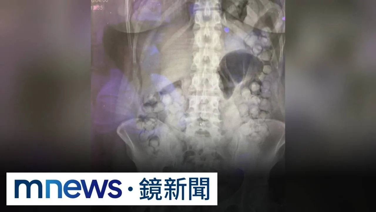 人體運毒！　泰女「腸道+下體」藏72顆毒膠囊