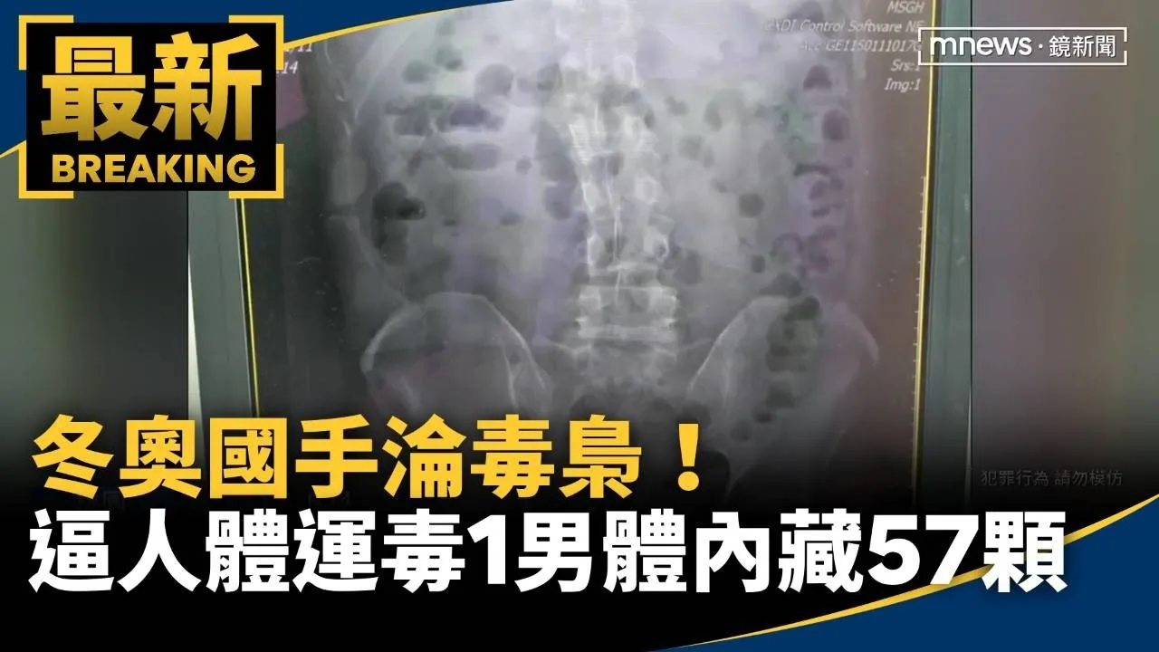 冬奧國手淪毒梟！　逼人體運毒「1男體內藏57顆」