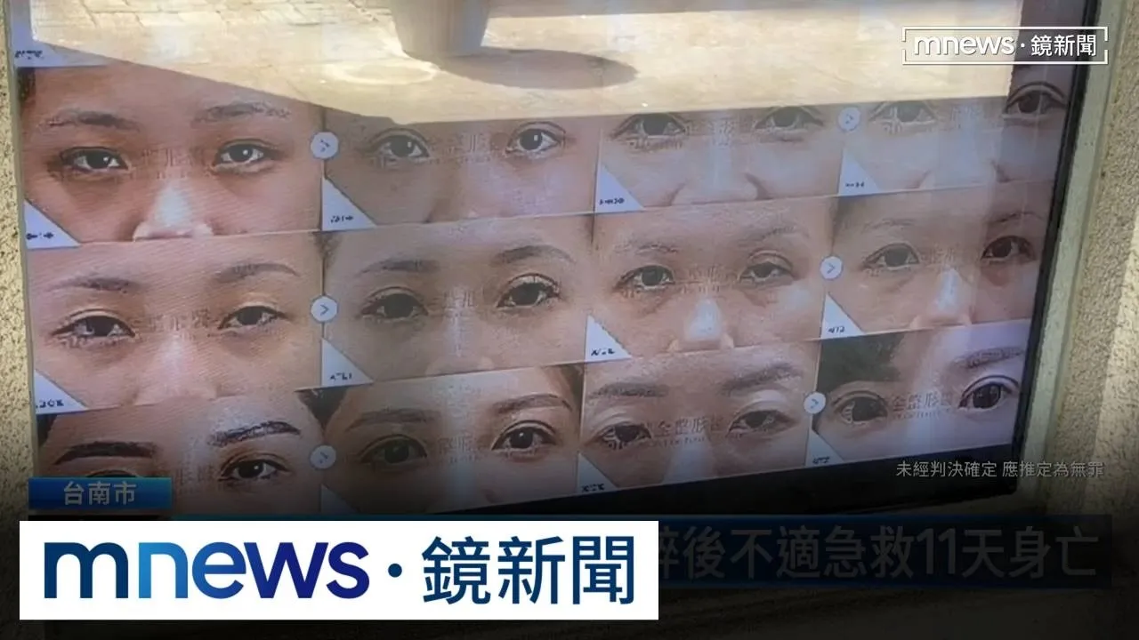 45歲女房仲割眼袋　麻醉後不適急救11天身亡