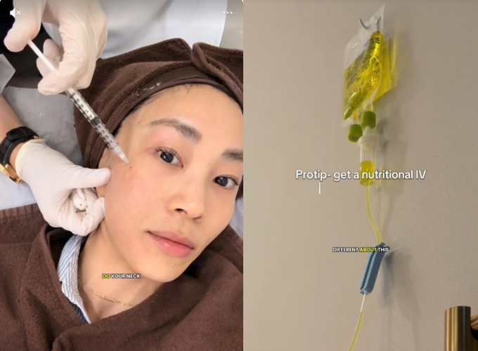 南韓醫美界近期掀起一股名為「Elravie Re2O」的抗老新熱潮,該療程主打使用逝者捐贈的皮膚組織進行純化後注射,藉此達到緊緻肌膚、淡化細紋的效果。(翻攝自抖音)