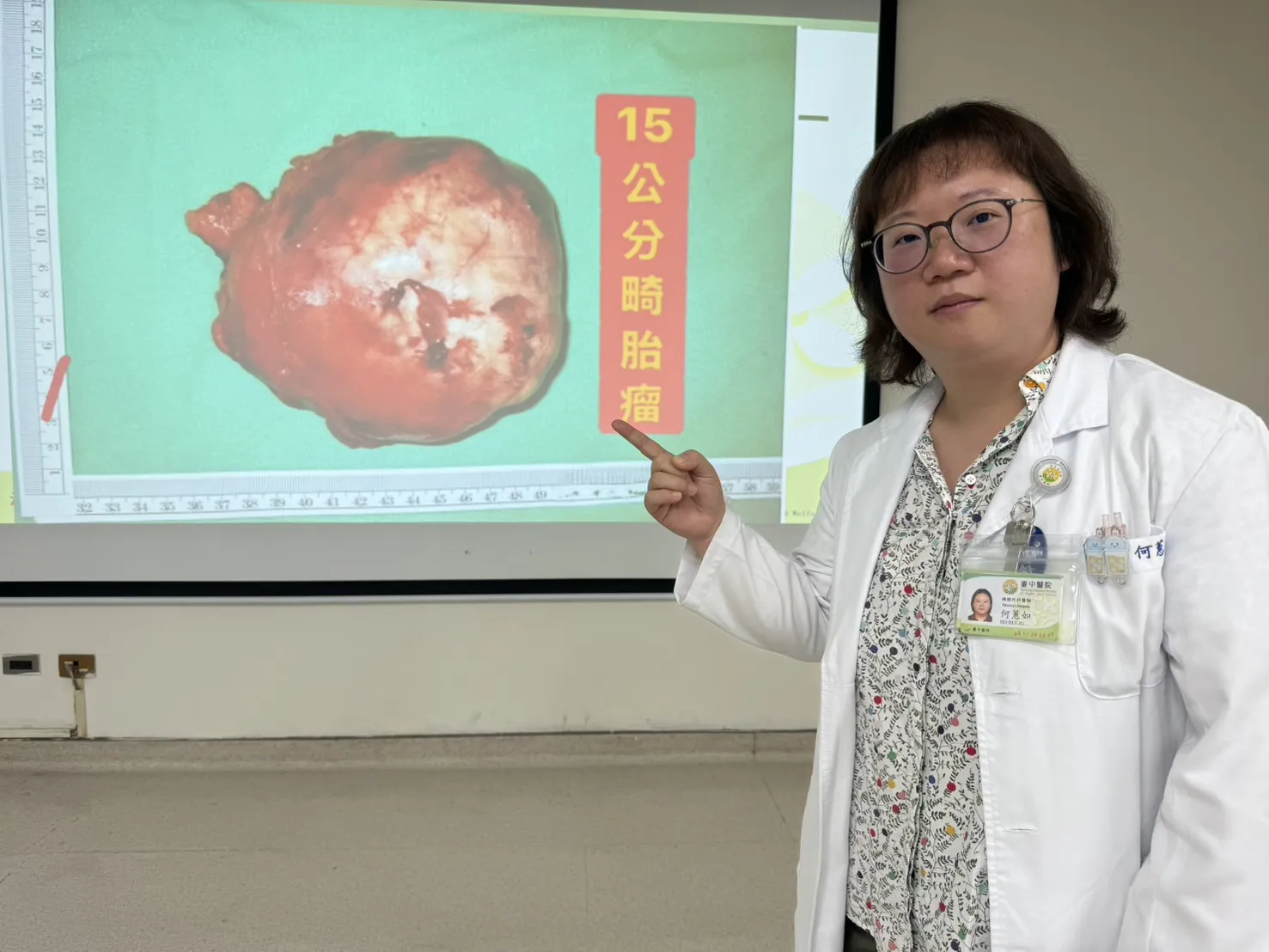 驚見15公分巨大腫瘤和心臟一樣大！　醫師：母體胚胎發育的畸胎瘤