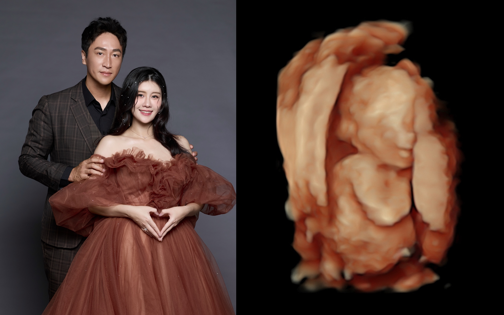 女星林真亦在寶寶滿21週當天,忍痛做出引產的決定。(翻攝自林真亦 IG)