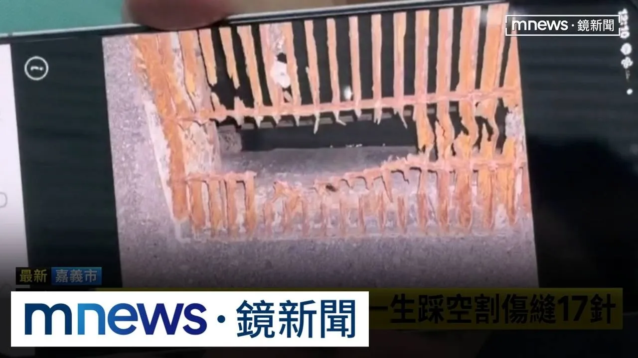 水溝蓋破洞割傷踩空男　國一生慘縫17針
