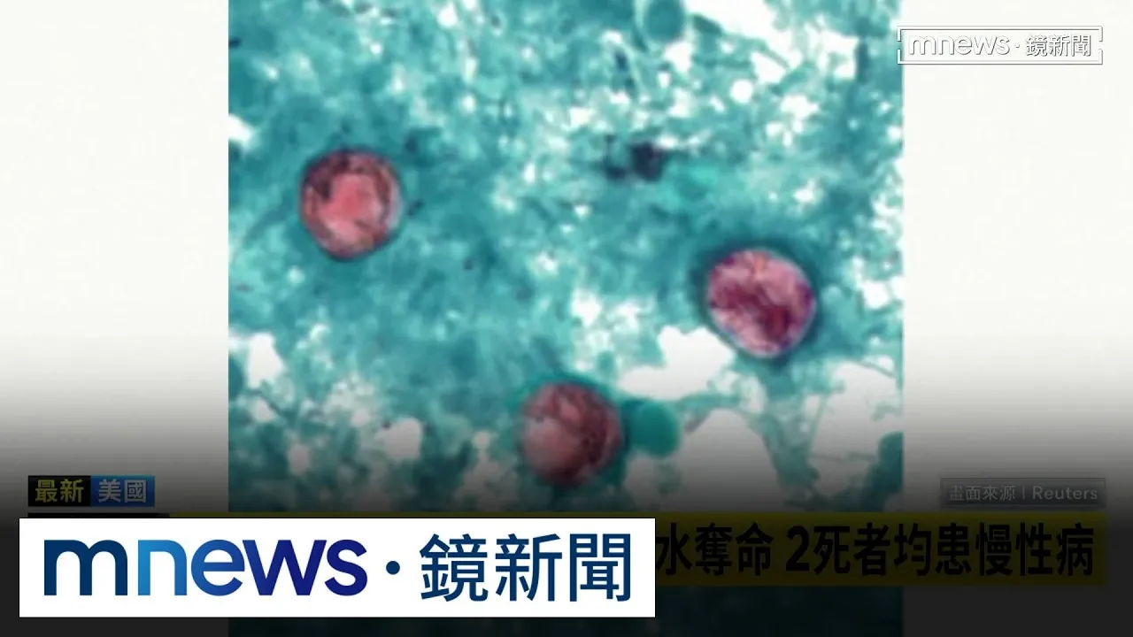 「環孢子蟲病」疫情擴大！　美密西根州首傳2例死亡