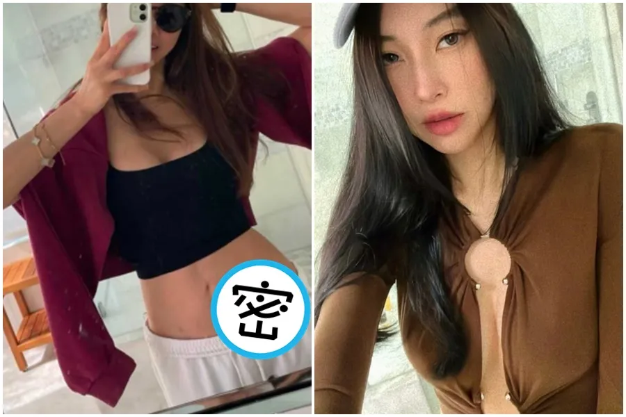 孫芸芸49歲親姊近況曝光！自拍「腹部傷疤」掀關注　腎臟移植980天...孫瑩瑩感性吐心聲