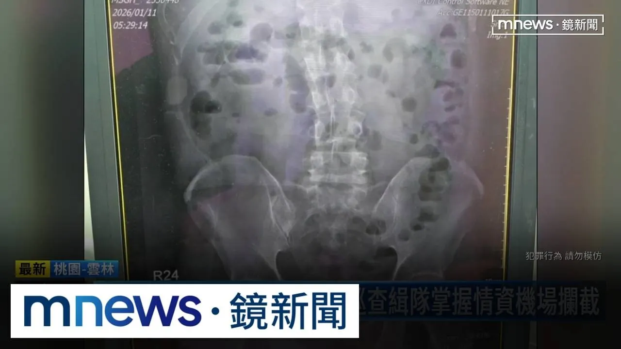 「門徒」真實上演？　「人體運毒」男體內起獲57顆海洛因球