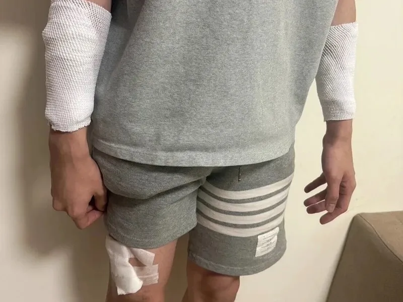 大反轉！苗栗男護理師遭人持美工刀砍傷　真相竟是工作「壓力大」自導自演