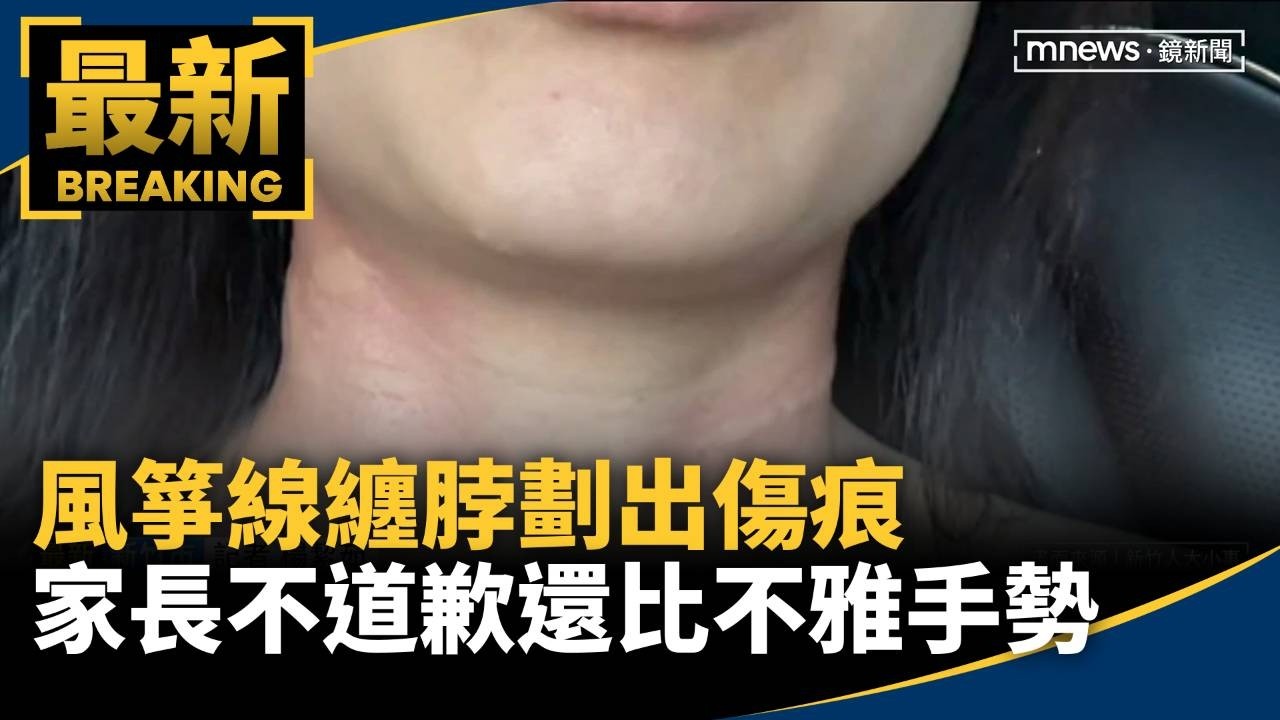 風箏線纏脖劃出傷痕　家長不道歉還比不雅手勢