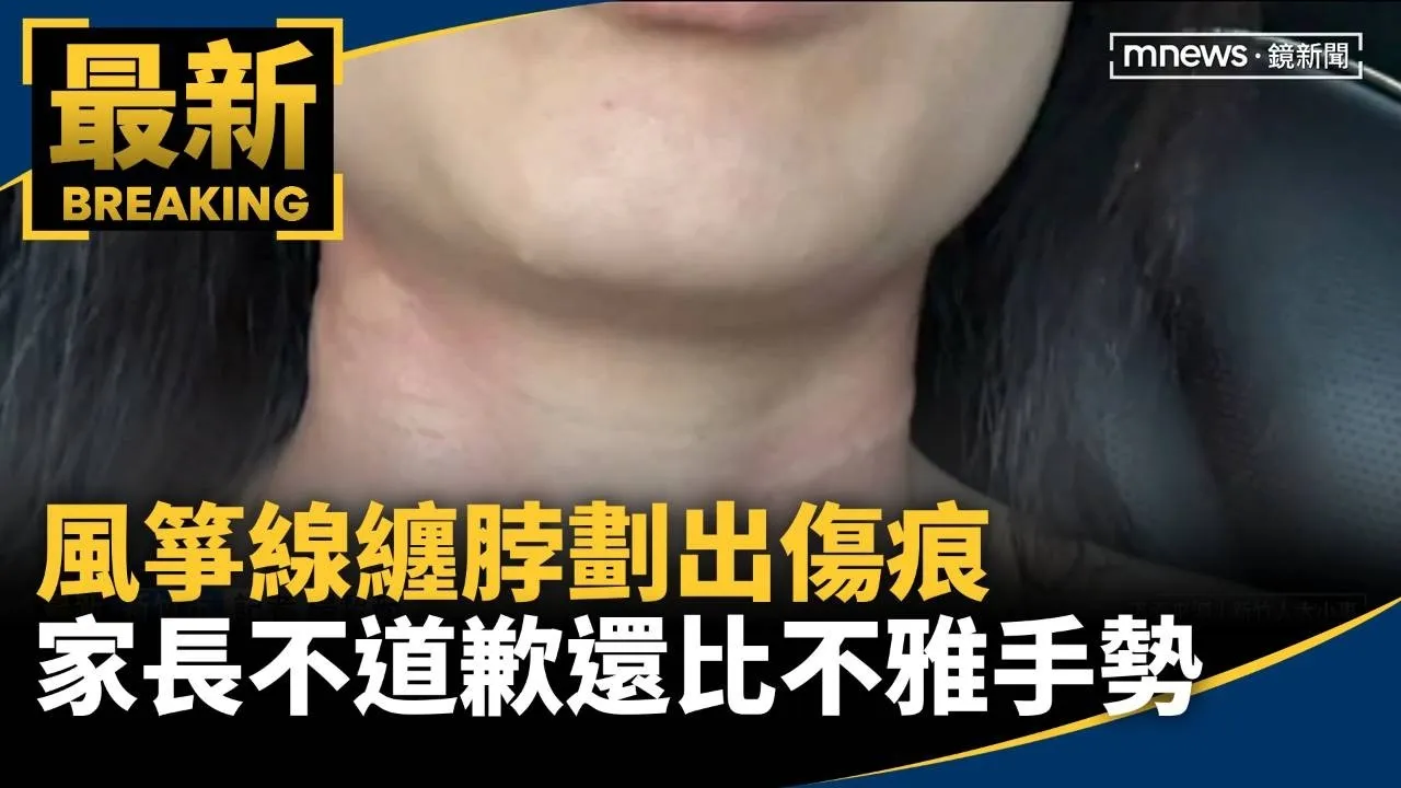 風箏線纏脖劃出傷痕　家長不道歉還比不雅手勢